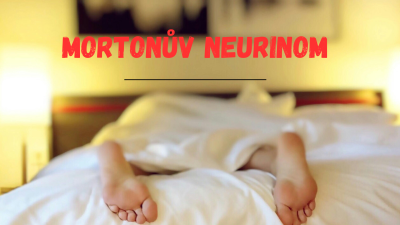 Mortonův neurinom: Bolest mezi prsty a brnění chodidla | ARNO.cz - obuv s tradicí